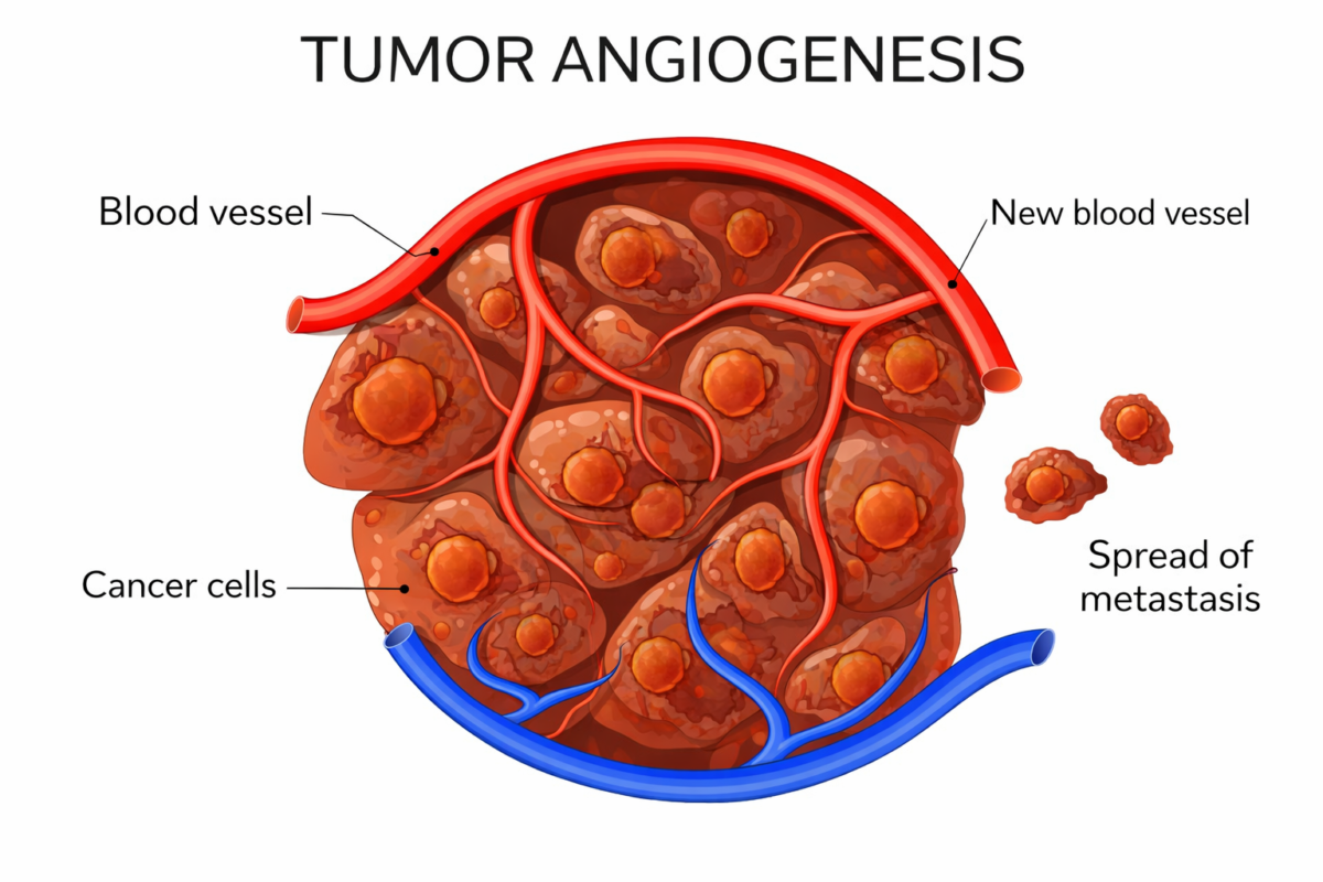 Cancer Explained: Types, Causes, Symptoms, Treatment & Prevention (Ultimate Guide)